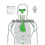 MTS – ANATOMIC